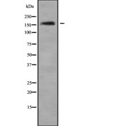 Western blot analysis of CD2L5 using HepG2 whole cell lysates.