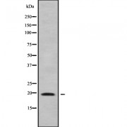 Western blot analysis of CKLF7 using K562 whole cell lysates.