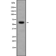 Western blot analysis of Cytochrome P450 11B2 using 293 whole cell lysates.