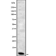 Western blot analysis of Defensin β 1 using Jurkat whole cell lysates.