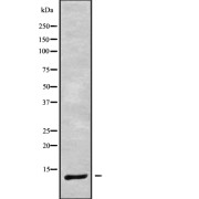 Western blot analysis of DYNLRB1 using Jurkat whole cell lysates.