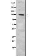 Western blot analysis of CD203c using 293 whole cell lysates.