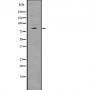 Western blot analysis of EZH2 (phospho Thr487) using HeLa whole cell lysates.