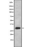 Western blot analysis of FFAR1 using K562 whole cell lysates.