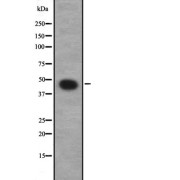 Western blot analysis of GNA12 expression in NT2D1 whole cell lysate. The lane on the left is treated with the antigen-specific peptide.