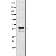 Western blot analysis of Inhibin β -C using 293 whole cell lysates.