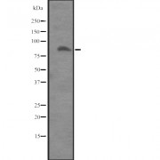 Western blot analysis of ITGB8 expression in Placenta lysate. The lane on the left is treated with the antigen-specific peptide.
