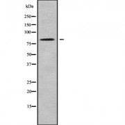 Western blot analysis of SV2C using K562 whole cell lysates.