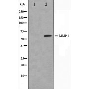 Western blot analysis of HepG2 cell lysate using MMP1 Ab. The lane on the left is treated with the antigen-specific peptide.