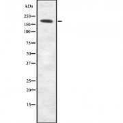 Western blot analysis of MYH2 using LOVO whole cell lysates.