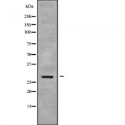 Western blot analysis of NOL7 using LOVO whole cell lysates.