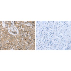 P2Y Purinoceptor 12 (P2RY12) Antibody