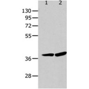 Western blot analysis of (1) 293T, and (2) HeLa cell lysates, using P2YR12 antibody (1/400 dilution).