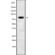 Western blot analysis of PIGQ using COLO205 whole cell lysates.