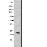 Western blot analysis of GAS3 using MDA-MB-435 whole cell lysates.