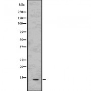 Western blot analysis of Parvalbumin using HeLa whole cell lysates.