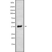 Western blot analysis of RNF167 using MCF7 whole cell lysates.