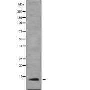 Western blot analysis of RPL37 using Jurkat whole cell lysates.