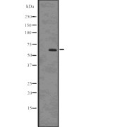 Western blot analysis of SQSTM1/p62 (Phospho-Ser403) using HepG2 whole cell lysates.