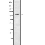 Western blot analysis of TMC7 using MCF7 whole cell lysates.