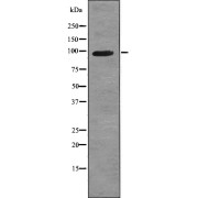 Western blot analysis VR1 (pS503) using NIH-3T3 whole cell lysates.