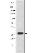 Western blot analysis of FA58A expression in HEK293 cells. The lane on the left is treated with the antigen-specific peptide.