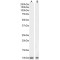 S100 Calcium Binding Protein B (S100B) Antibody