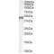 Creatine Kinase B-Type (CKB) Antibody