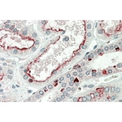 MAP Kinase-Activated Protein Kinase 5 (MAPKAPK5) Antibody