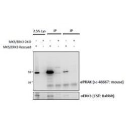 MAP Kinase-Activated Protein Kinase 5 (MAPKAPK5) Antibody