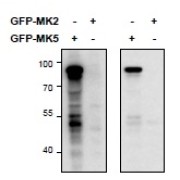 HEK293 lysate (10 µg protein in RIPA buffer) overexpressing Mouse MK5-GFP (first lane) or Mouse MK2-GFP (second lane) probed with abx430009 (0.5 µg/ml) in right panel and with abx430010 (0.5 µg/ml) on left panel, Primary incubations were for 2 hours. Detected by chemiluminescence.