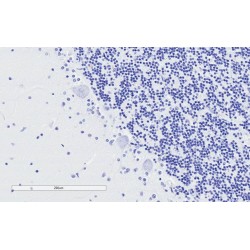 Tubulin Polymerization Promoting Protein (TPPP) Antibody