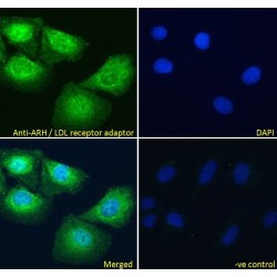 Low Density Lipoprotein Receptor Adapter Protein 1 (LDLRAP1) Antibody