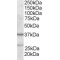 ARP2 / 3 subunit 1B Antibody