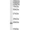 Target of Methylation-Induced Silencing 1 (TMS1) Antibody