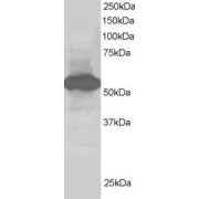 abx430021 staining (1 µg/ml) of Human Kidney lysate (RIPA buffer, 30 µg total protein per lane). Primary incubated for 1 hour. Detected by chemiluminescence.