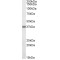 TNF Receptor Superfamily Member 6 / CD95 / TNFRSF6 (FAS) Antibody