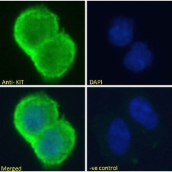 Mast/Stem Cell Growth Factor Receptor Kit (KIT) Antibody