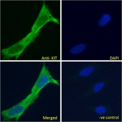 Mast/Stem Cell Growth Factor Receptor Kit (KIT) Antibody