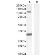 abx430032 (1 µg/ml) staining of Human Hippocampus lysate (A) + peptide (B) (35 µg protein in RIPA buffer). Detected by chemiluminescence.