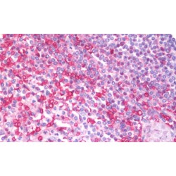 Melanoma Inhibitory Activity (MIA) Antibody