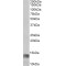 Melanoma Inhibitory Activity (MIA) Antibody