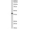 Protein SET (SET) Antibody