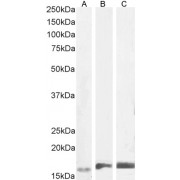 Western blot analysis of Human frontal cortex lysate using Allograft Inflammatory Factor 1 (AIF1) Antibody (2 µg/ml).