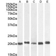 abx430054 (0.03 µg/ml) staining of A431 (A), HeLa (B), HepG2 (C), Jurkat (D) and K562 (E) nuclear cell lysate. (35 µg protein in RIPA buffer). Detected by chemiluminescence.