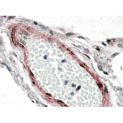 Cysteine And Glycine Rich Protein 2 (CSRP2) Antibody