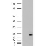 abx430061 (0.2 µg/ml) staining of Human (A), Mouse (B) and Rat (C) Kidney lysates (35 µg protein in RIPA buffer). Detected by chemiluminescence