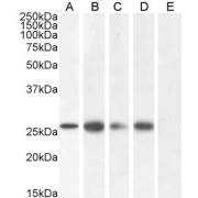 abx430076 (1 µg/ml) staining of Human Colon (A), Heart (B), Prostate (C), Skin (D) and negative control Adipose (E) lysate (35 µg protein in RIPA buffer). Detected by chemiluminescence.