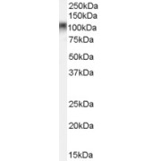 abx430085 (0.1 µg/ml) staining of rat stomach lysate (35 µg protein in RIPA buffer). Primary incubation was 1 hour. Detected by chemiluminescence.