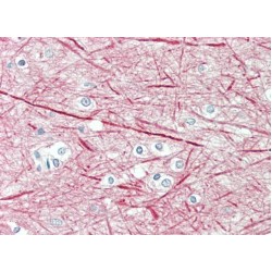 Neurofilament Medium Polypeptide (NEFM) Antibody